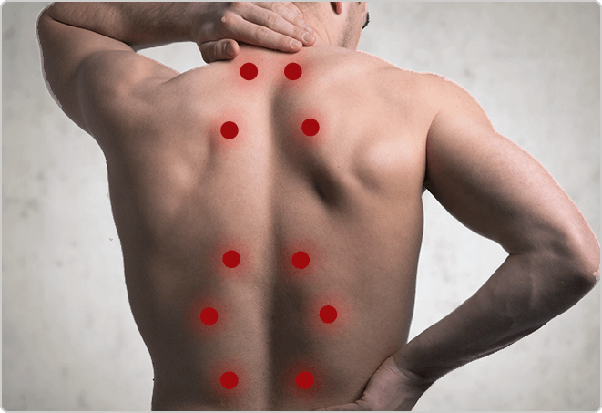 Vitality Healthcare Trigger Point Injections